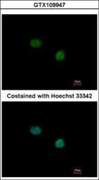 Anti-TTF2 antibody used in Immunocytochemistry/ Immunofluorescence (ICC/IF). GTX109947