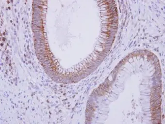 Anti-C9 antibody [N2C2], Internal used in IHC (Paraffin sections) (IHC-P). GTX109952