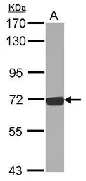 Anti-C9 antibody [N2C2], Internal used in Western Blot (WB). GTX109952