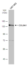Anti-COL6A1 antibody [C1C2], Internal used in Western Blot (WB). GTX109963
