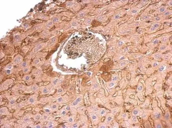 Anti-COL6A1 antibody [C1C2], Internal used in IHC (Paraffin sections) (IHC-P). GTX109963