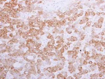 Anti-58K Golgi protein antibody [N1N3] used in IHC (Paraffin sections) (IHC-P). GTX109972