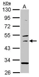 Anti-USH1G antibody [N2C2], Internal used in Western Blot (WB). GTX109975
