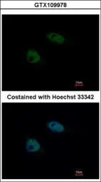 Anti-NCOA62 antibody [N3C3] used in Immunocytochemistry/ Immunofluorescence (ICC/IF). GTX109978