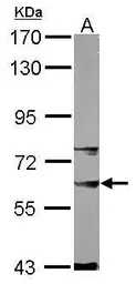 Anti-NCOA62 antibody [N3C3] used in Western Blot (WB). GTX109978