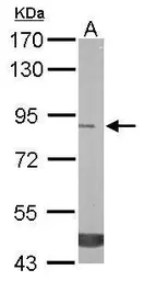 Anti-Trehalase antibody [N1N3] used in Western Blot (WB). GTX109979
