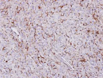Anti-Trehalase antibody [N1N3] used in IHC (Paraffin sections) (IHC-P). GTX109979