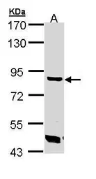 Anti-Trehalase antibody [N1N3] used in Western Blot (WB). GTX109979