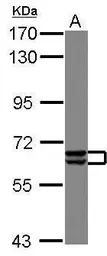 Anti-PAK3 antibody used in Western Blot (WB). GTX109991
