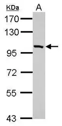Anti-PDE11A antibody used in Western Blot (WB). GTX110015