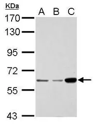 Anti-CDKAL1 antibody used in Western Blot (WB). GTX110020
