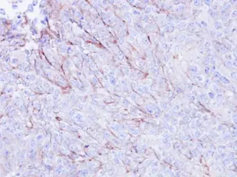 Anti-CDKAL1 antibody used in IHC (Paraffin sections) (IHC-P). GTX110020
