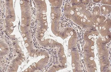 Anti-NPR-C antibody [N3C3] used in IHC (Paraffin sections) (IHC-P). GTX110023