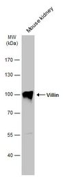 Anti-Villin antibody used in Western Blot (WB). GTX110034