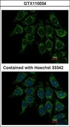 Anti-Villin antibody used in Immunocytochemistry/ Immunofluorescence (ICC/IF). GTX110034