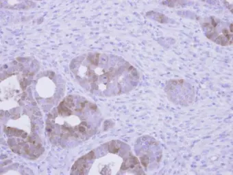 Anti-Villin antibody used in IHC (Paraffin sections) (IHC-P). GTX110034