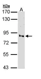 Anti-Villin antibody used in Western Blot (WB). GTX110034