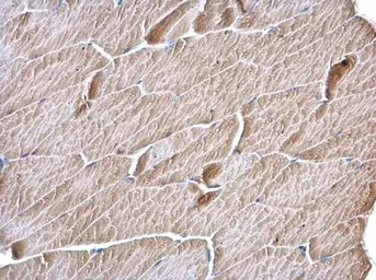 Anti-MCD antibody [N2C1], Internal used in IHC (Paraffin sections) (IHC-P). GTX110037