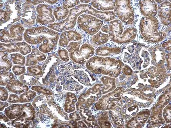 Anti-MCD antibody [N2C1], Internal used in IHC (Paraffin sections) (IHC-P). GTX110037