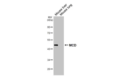 Anti-MCD antibody [N2C1], Internal used in Western Blot (WB). GTX110037