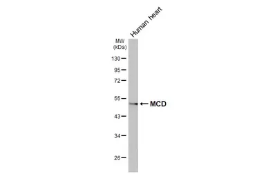 Anti-MCD antibody [N2C1], Internal used in Western Blot (WB). GTX110037