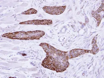 Anti-MCD antibody [N2C1], Internal used in IHC (Paraffin sections) (IHC-P). GTX110037