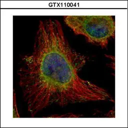 Anti-EPHX1 antibody used in Immunocytochemistry/ Immunofluorescence (ICC/IF). GTX110041