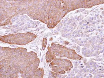Anti-EPHX1 antibody used in IHC (Paraffin sections) (IHC-P). GTX110041