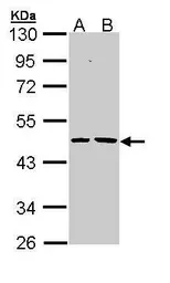 Anti-EPHX1 antibody used in Western Blot (WB). GTX110041