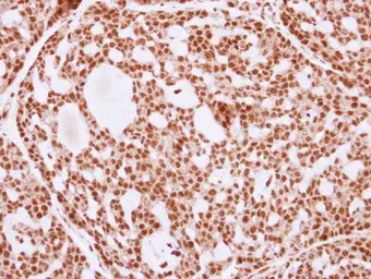 Anti-Ku80 antibody [N1N3] used in IHC (Paraffin sections) (IHC-P). GTX110046
