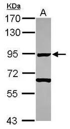 Anti-Ku80 antibody [N1N3] used in Western Blot (WB). GTX110046