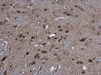 Anti-CYP2R1 antibody [N1C2] used in IHC (Paraffin sections) (IHC-P). GTX110050