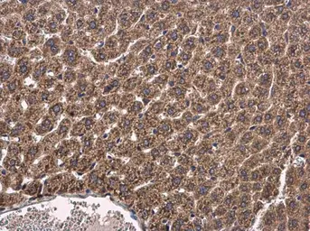 Anti-CYP2R1 antibody [N1C2] used in IHC (Paraffin sections) (IHC-P). GTX110050
