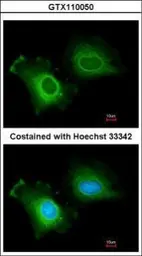 Anti-CYP2R1 antibody [N1C2] used in Immunocytochemistry/ Immunofluorescence (ICC/IF). GTX110050