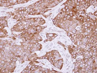 Anti-CYP2R1 antibody [N1C2] used in IHC (Paraffin sections) (IHC-P). GTX110050