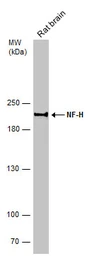Anti-NF-H antibody used in Western Blot (WB). GTX110065