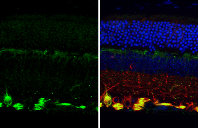 Anti-NF-H antibody used in IHC (Paraffin sections) (IHC-P). GTX110065