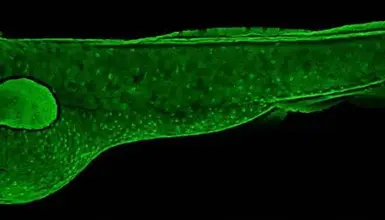 Anti-Alpha 2 Antiplasmin antibody [N3C3] used in IHC (Whole mount) (IHC-Wm). GTX110076