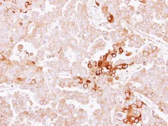 Anti-Alpha 2 Antiplasmin antibody [N3C3] used in IHC (Paraffin sections) (IHC-P). GTX110076