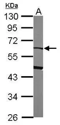 Anti-Alpha 2 Antiplasmin antibody [N3C3] used in Western Blot (WB). GTX110076