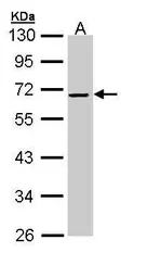 Anti-Alpha 2 Antiplasmin antibody [N3C3] used in Western Blot (WB). GTX110076
