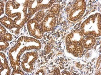 Anti-Myosin 1A antibody [N2C1], Internal used in IHC (Paraffin sections) (IHC-P). GTX110081