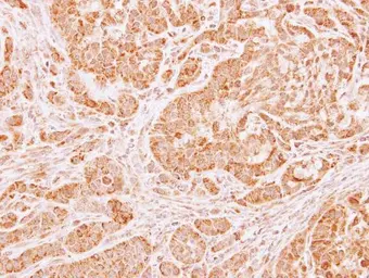 Anti-LARS2 antibody [N2C1], Internal used in IHC (Paraffin sections) (IHC-P). GTX110083