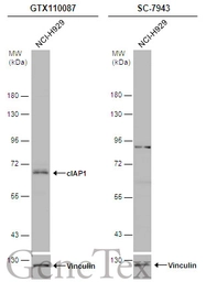 Anti-cIAP1 antibody used in Western Blot (WB). GTX110087