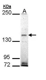 Anti-EHBP1 antibody [N3C2], Internal used in Western Blot (WB). GTX110102