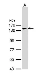 Anti-NPR-A antibody [C1C3-2] used in Western Blot (WB). GTX110112