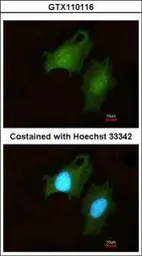 Anti-DIP2B antibody [C2C3-2], C-term used in Immunocytochemistry/ Immunofluorescence (ICC/IF). GTX110116