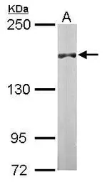 Anti-DIP2B antibody [C2C3-2], C-term used in Western Blot (WB). GTX110116