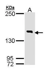 Anti-DIP2B antibody [C2C3-2], C-term used in Western Blot (WB). GTX110116