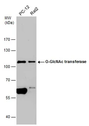 Anti-O-GlcNAc transferase antibody [N1N2], N-term used in Western Blot (WB). GTX110136